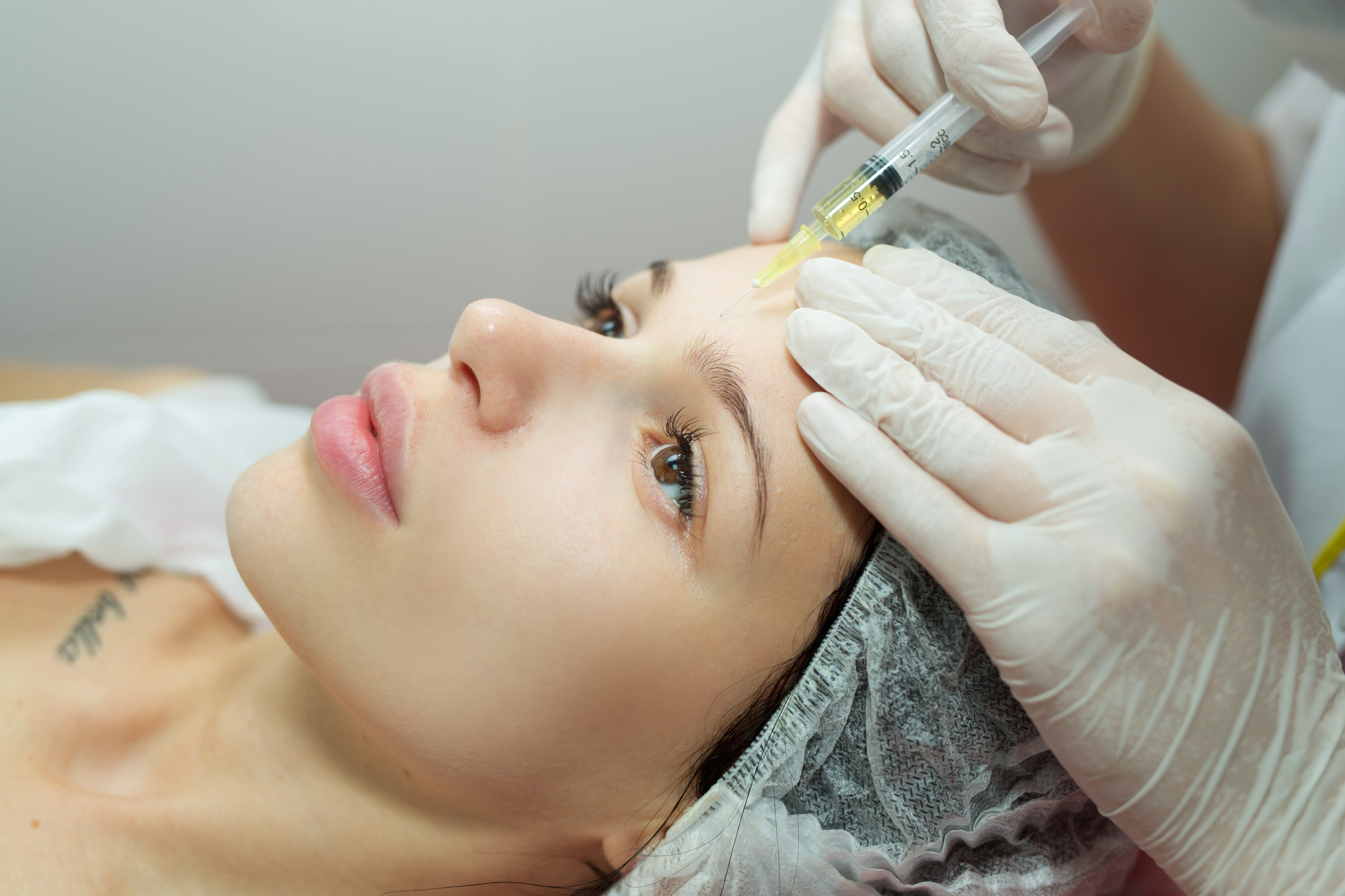 Woman receiving a forehead injection for cosmetic treatment.